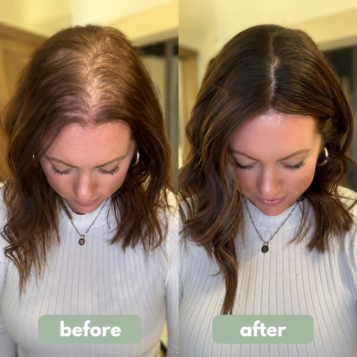 MRGROWTH™ Hair Density Roll-On Serum
