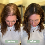 MRGROWTH™ Hair Density Roll-On Serum