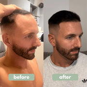 MRGROWTH™ Hair Density Roll-On Serum
